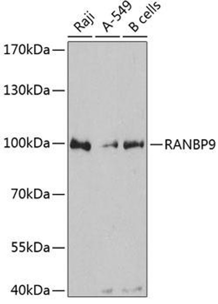 Cell Biology Antibodies 2 Anti-RANBP9 Antibody CAB12097