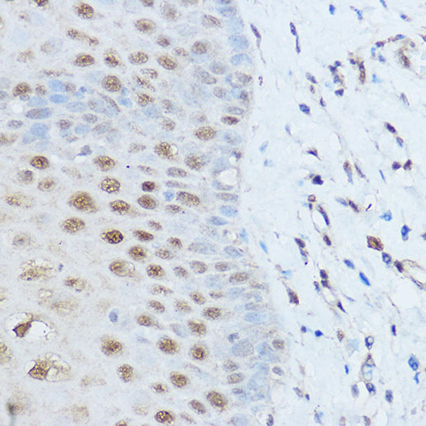 Epigenetics and Nuclear Signaling Antibodies 1 Anti-SMARCD2 Antibody CAB12104