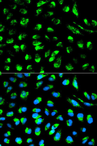 Metabolism Antibodies 1 Anti-ECI1 Antibody CAB1211