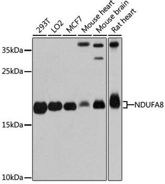 Cell Biology Antibodies 2 Anti-NDUFA8 Antibody CAB12118