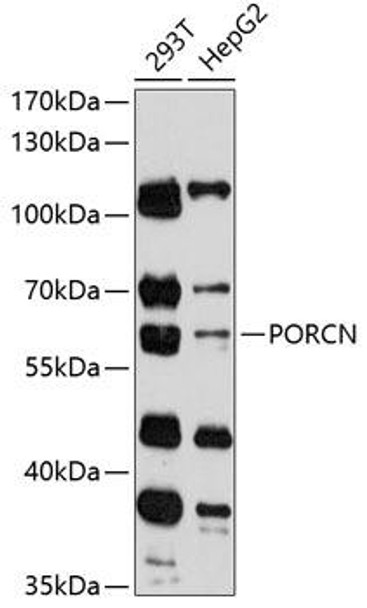 Metabolism Antibodies 1 Anti-PORCN Antibody CAB12120