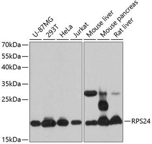 Cell Biology Antibodies 2 Anti-RPS24 Antibody CAB12123