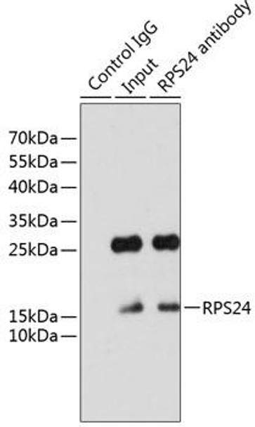Cell Biology Antibodies 2 Anti-RPS24 Antibody CAB12123