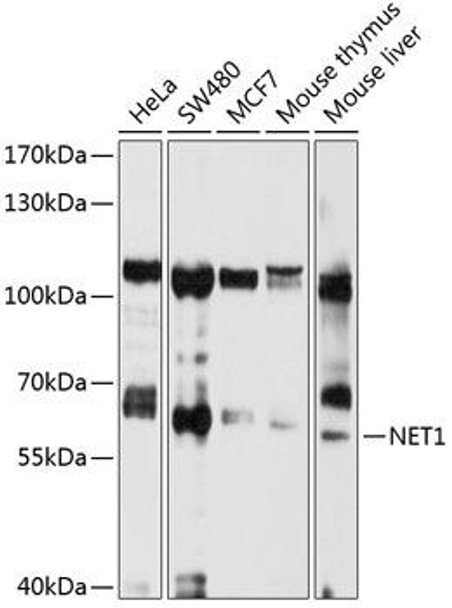Cell Biology Antibodies 2 Anti-NET1 Antibody CAB1213