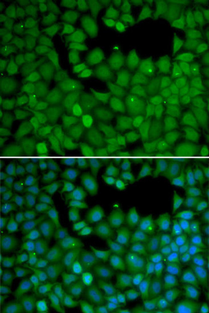 Cell Biology Antibodies 2 Anti-NET1 Antibody CAB1213