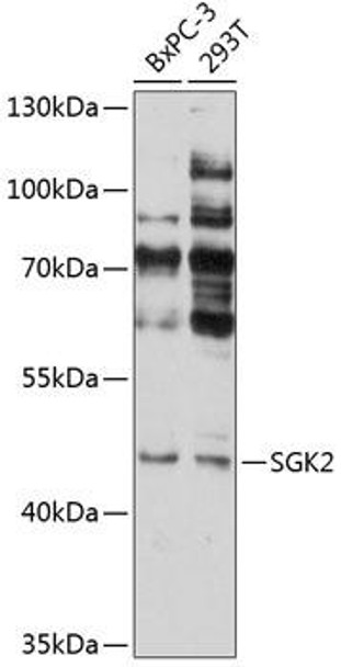 Cell Biology Antibodies 2 Anti-SGK2 Antibody CAB12137