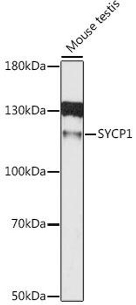 Cell Cycle Antibodies 1 Anti-SYCP1 Antibody CAB12139