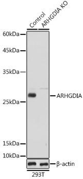 KO Validated Antibodies 1 Anti-ARHGDIA Antibody CAB1214KO Validated
