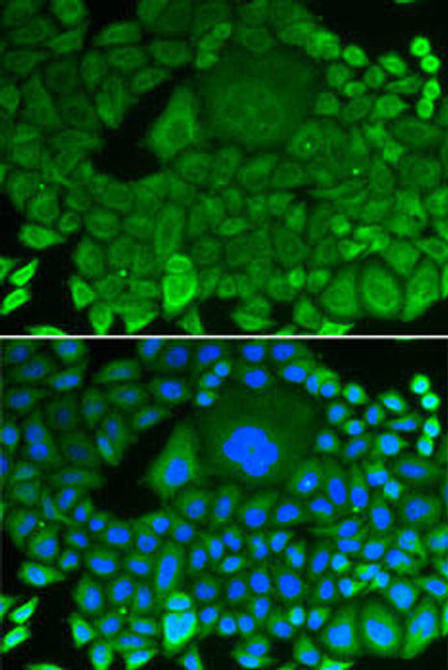 KO Validated Antibodies 1 Anti-ARHGDIA Antibody CAB1214KO Validated