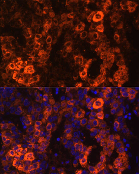 Cell Biology Antibodies 2 Anti-BHMT Antibody CAB1216