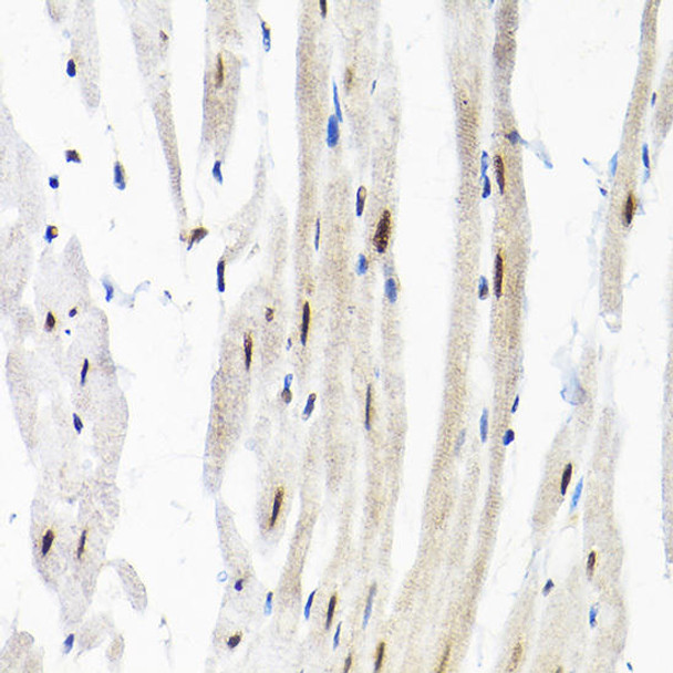 Epigenetics and Nuclear Signaling Antibodies 1 Anti-SNRPF Antibody CAB12162