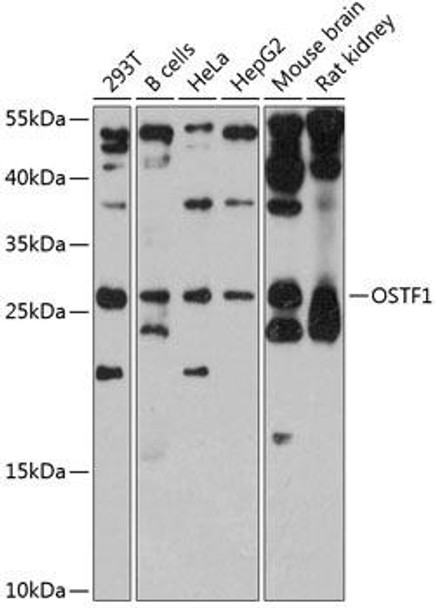 Cell Biology Antibodies 2 Anti-OSTF1 Antibody CAB12169