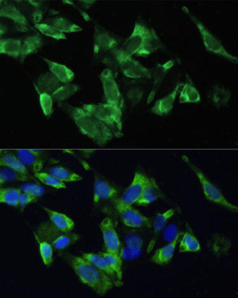 Signal Transduction Antibodies 1 Anti-PMEPA1 Antibody CAB12171