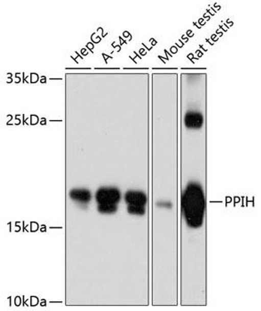 Epigenetics and Nuclear Signaling Antibodies 1 Anti-PPIH Antibody CAB12172