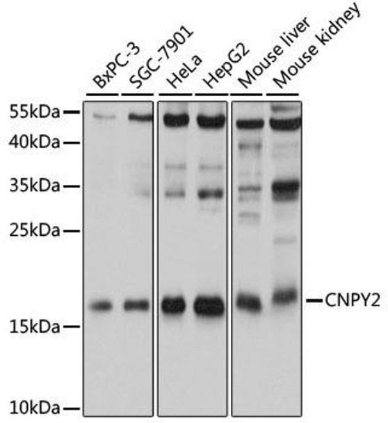 Cell Biology Antibodies 2 Anti-CNPY2 Antibody CAB12197