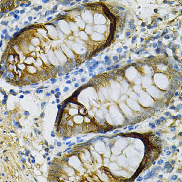 KO Validated Antibodies 1 Anti-SELENBP1 Antibody CAB1222KO Validated