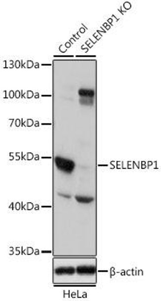 KO Validated Antibodies 1 Anti-SELENBP1 Antibody CAB1222KO Validated