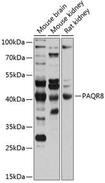 Developmental Biology Anti-PAQR8 Antibody CAB12221