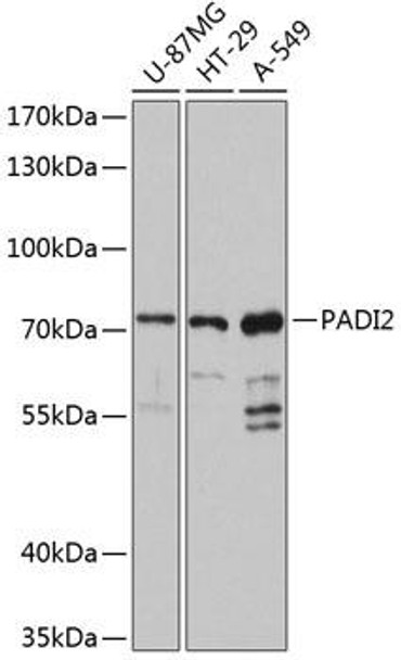 Cell Biology Antibodies 2 Anti-PADI2 Antibody CAB12236