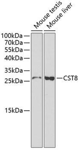 Cell Biology Antibodies 2 Anti-CST8 Antibody CAB1224