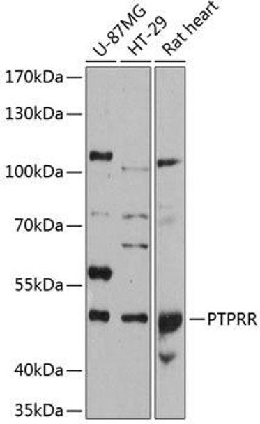 Cell Biology Antibodies 2 Anti-PTPRR Antibody CAB12246