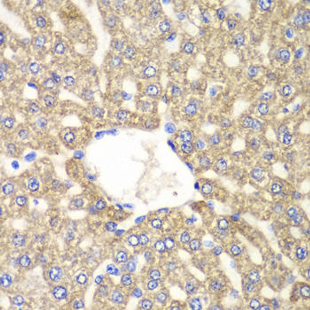 Cell Biology Antibodies 2 Anti-ALDH2 Antibody CAB1226