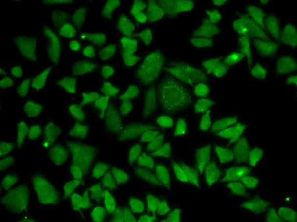 Cell Biology Antibodies 2 Anti-ALDH2 Antibody CAB1226