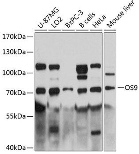 Cell Biology Antibodies 2 Anti-OS9 Antibody CAB12261