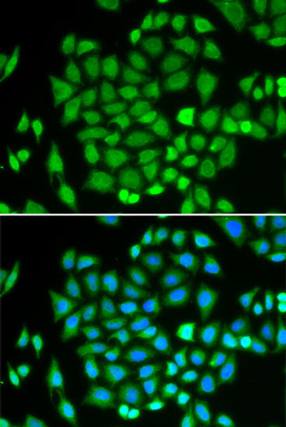 Cell Biology Antibodies 2 Anti-AKR7A2 Antibody CAB1227