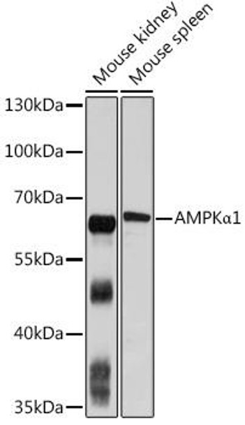 Autophagy Antibodies Anti-AMPKAlpha1 Antibody CAB1229