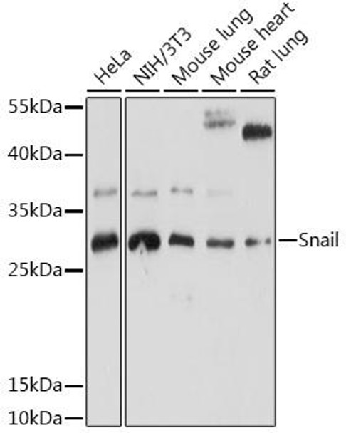 Cell Biology Antibodies 2 Anti-Snail Antibody CAB12301