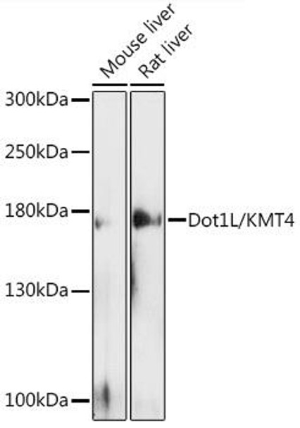 Cell Biology Antibodies 2 Anti-Dot1L/KMT4 Antibody CAB12328