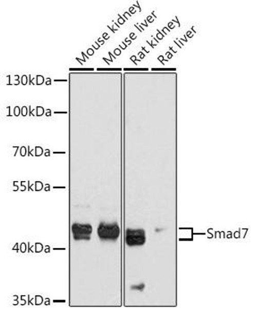 Epigenetics and Nuclear Signaling Antibodies 1 Anti-Smad7 Antibody CAB12343