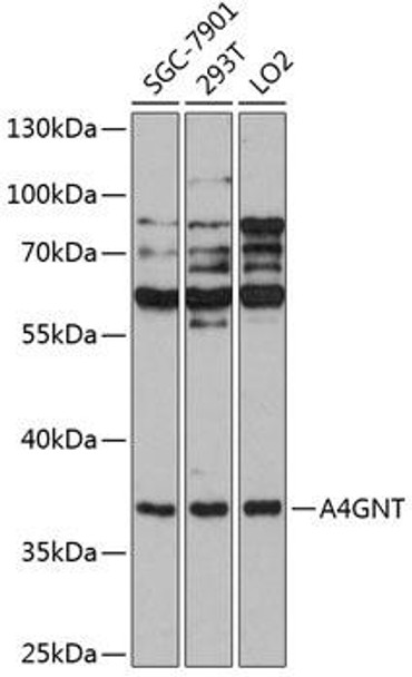 Signal Transduction Antibodies 1 Anti-A4GNT Antibody CAB12366