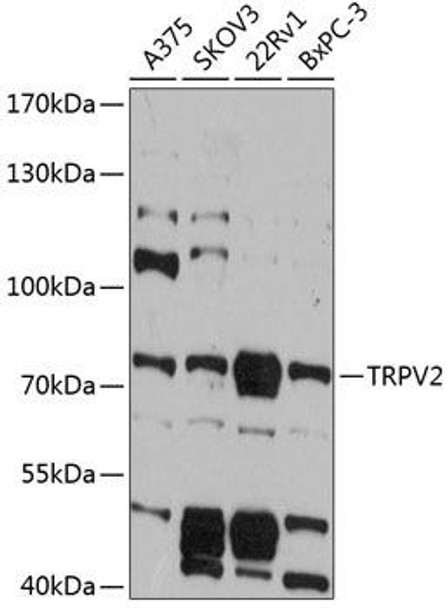 Cell Biology Antibodies 2 Anti-TRPV2 Antibody CAB12367