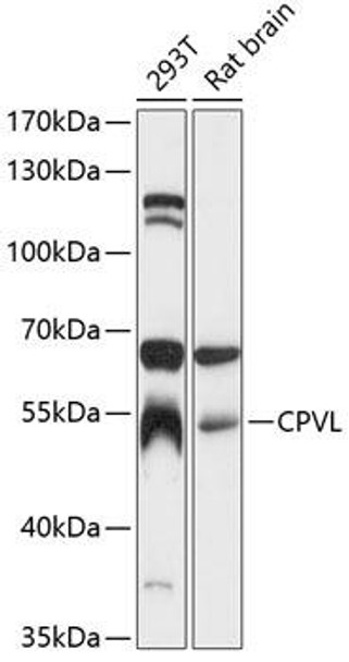 Cell Biology Antibodies 2 Anti-CPVL Antibody CAB12370
