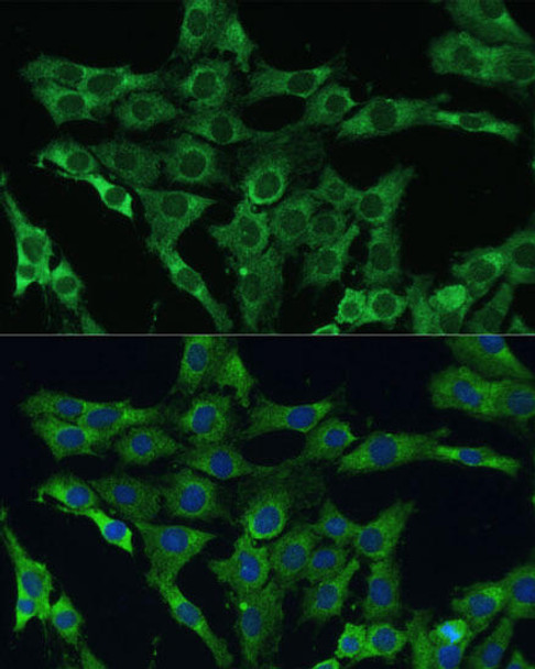 Cell Death Antibodies 1 Anti-PLSCR3 Antibody CAB12371