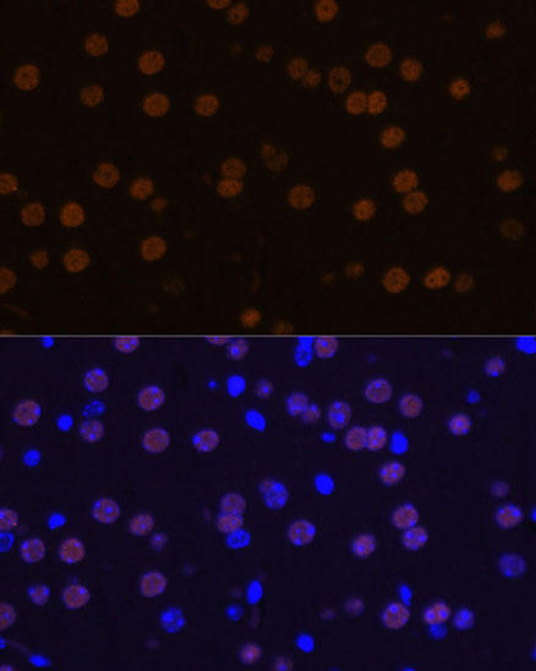 Cell Death Antibodies 1 Anti-MEF2C Antibody CAB12385