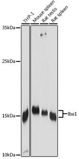 Cell Biology Antibodies 3 Anti-Iba1 Antibody CAB12391