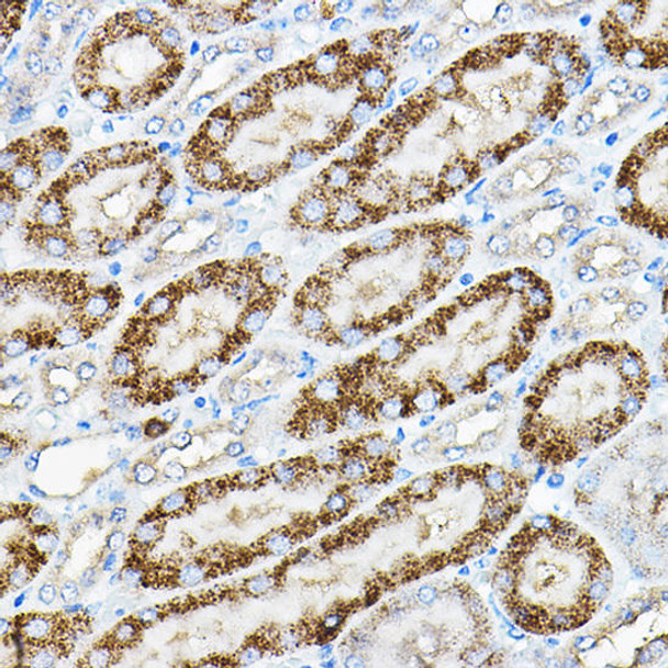 Signal Transduction Antibodies 1 Anti-ALPL Antibody CAB12396