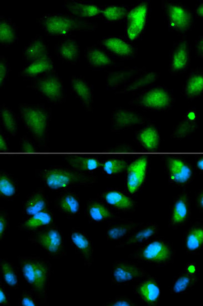 Immunology Antibodies 1 Anti-F11R Antibody CAB1241