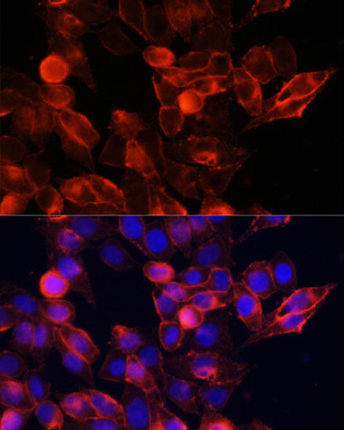 KO Validated Antibodies 1 Anti-CD44 Antibody CAB12410KO Validated