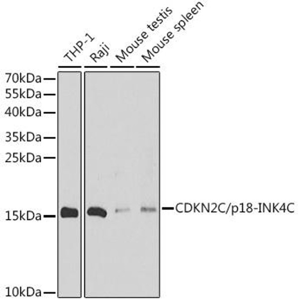 Cell Cycle Antibodies 1 Anti-CDKN2C/p18-INK4C Antibody CAB12418