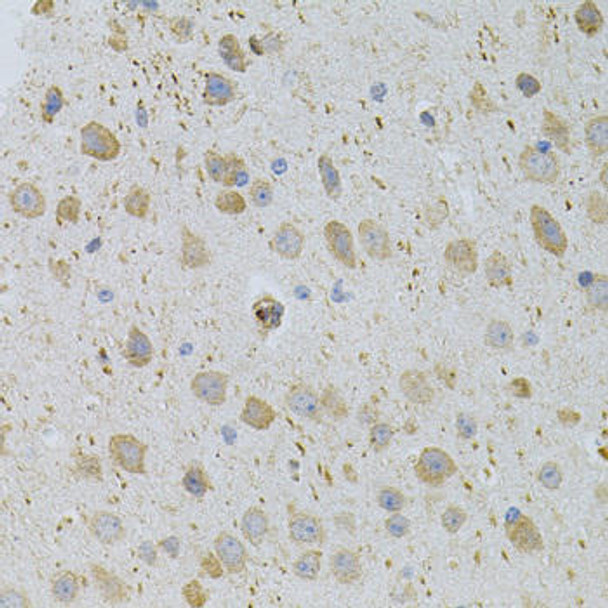 Cell Cycle Antibodies 1 Anti-CDKN2C/p18-INK4C Antibody CAB12418