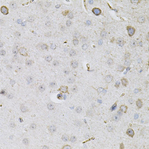 Cell Death Antibodies 1 Anti-CEACAM5 Antibody CAB12421