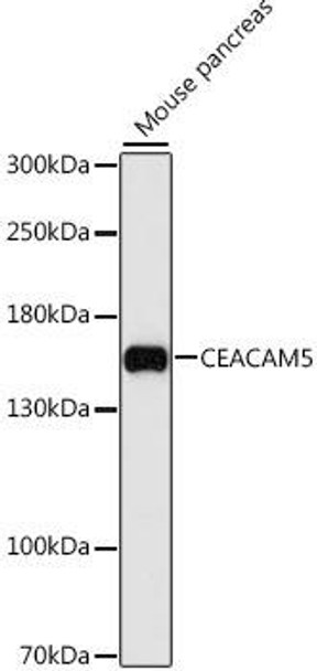 Cell Death Antibodies 1 Anti-CEACAM5 Antibody CAB12421