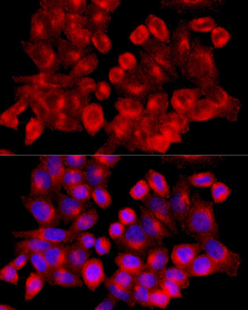 Autophagy Antibodies Anti-CLTC Antibody CAB12423