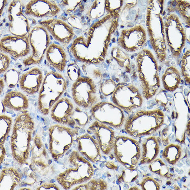 Epigenetics and Nuclear Signaling Antibodies 1 Anti-Ataxin 3 Antibody CAB1243