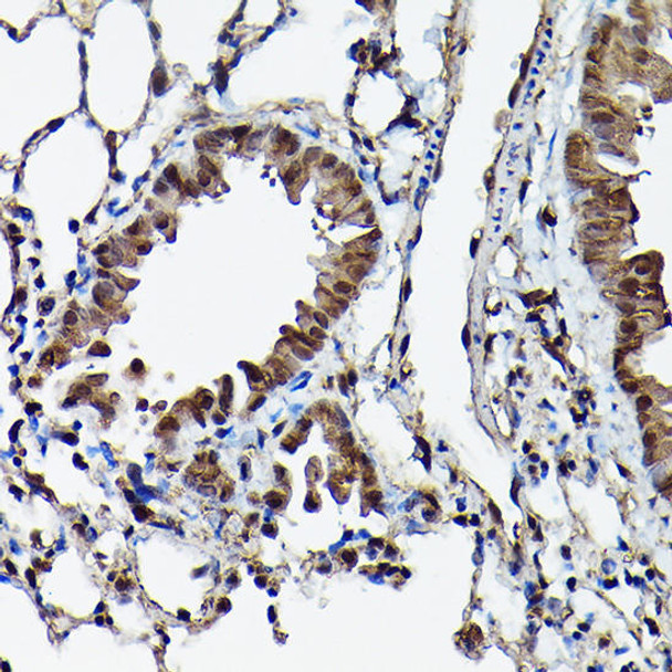 Epigenetics and Nuclear Signaling Antibodies 1 Anti-Ataxin 3 Antibody CAB1243