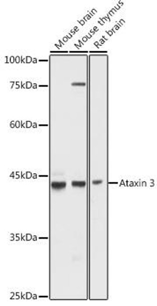 Epigenetics and Nuclear Signaling Antibodies 1 Anti-Ataxin 3 Antibody CAB1243